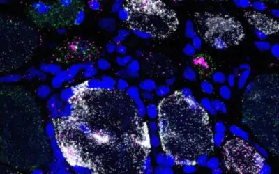 GADD45A: DNA-Schädigungsmarker detektieren Muskelschwund