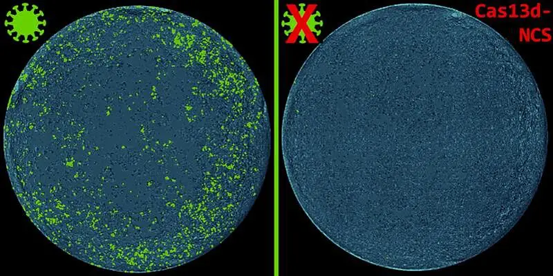 Behandlung mit Cas13d-NCS verhindert die Ausbreitung von SARS-CoV-2 (grün). Credits: Helmholtz Zentrum München Deutsches Forschungszentrum für Gesundheit und Umwelt (GmbH)