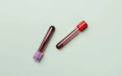 Menschen mit Bluthochdruck benötigen fundierte Labordiagnostik