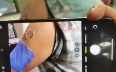 Tragbares Pflaster aus dem 3D-Drucker misst Biomarker im Schweiß