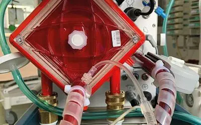 Akutes Lungenversagen: Veränderte Thrombozyten unter ECMO erhöhen das Sterberisiko