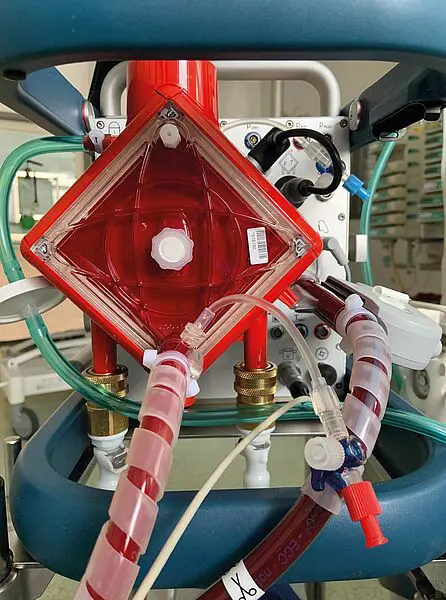 Die Extrakorporale Membranoxygenierung (ECMO) basiert auf einer pumpenunterstützten Blutumleitung, bei der über eine Membrane das Kohlendioxid entfernt und gleichzeitig das Blut mit Sauerstoff angereichert wird. | Copyright: UKW 