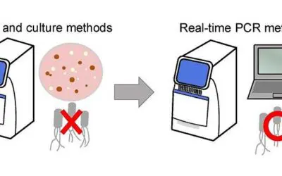 Echtzeit-PCR-Methode könnte diagnostisches Hilfsmittel für neu auftretende Bakterien werden
