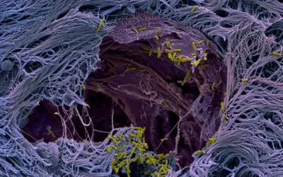 Infektionsforschung setzt auf Mini-Lungen und neue Sensoren