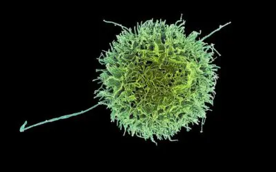 Natürliche Killerzellen behindern CAR-T Zelltherapie