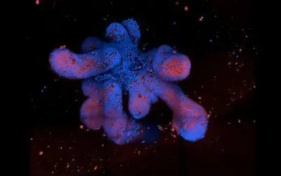Organoide: Künstlicher Mini-Darm soll Therapien für Morbus Crohn voranbringen