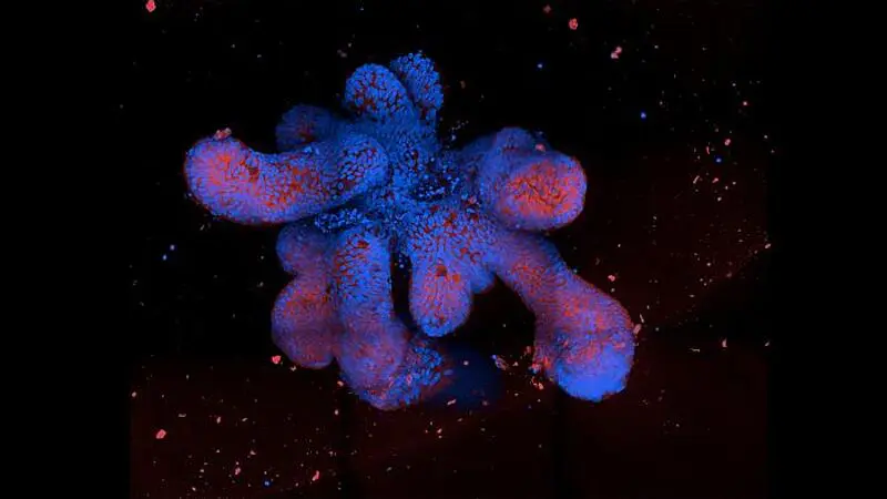 Immunofluoreszenz-Aufnahme eines Darm-Organoids. Credits: Thomas Dennison/University of Cambridge