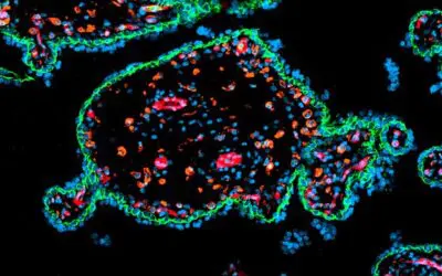 Präeklampsie: Proteomanalysen bescheren Forschenden 700.000 Euro – Grant