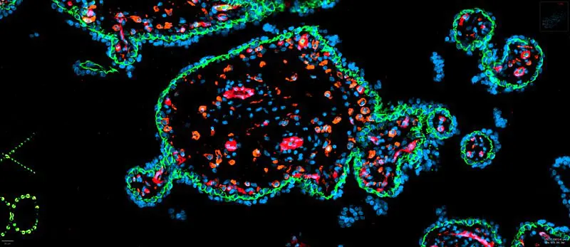 Plazentazotte: Umrandet ist sie von grünen Trophoblasten – das sind die äußeren Zellschichten der Keimblase, die am vierten Tag nach der Befruchtung aus der mehrfach geteilten Eizelle entsteht. Die fetalen Gefäße sind rot, die Hofbauerzellen orange.  Copyright: Max Delbrück Center