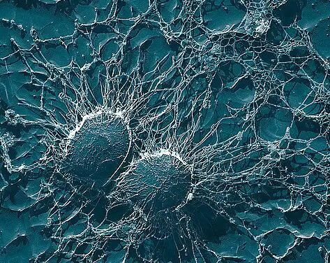 AMI-Warnung während der Weltwoche zur Sensibilisierung für Antibiotikaresistenzen (WAAW)