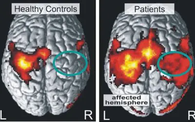 Neuropalliative Betten: Universitätsmedizin Greifswald stockt auf