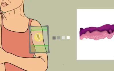 Virtuelle Biopsie ermöglicht Klinikern die nicht-invasive Analyse der Haut