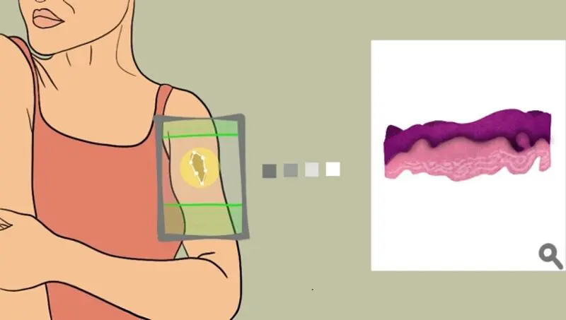 Forscher der Stanford Medicine haben eine Methode entwickelt, um Gewebe mit Lasern zu durchdringen und ein hochauflösendes, dreidimensionales Bild der Zellen zu erstellen. Credits: Emily Moskal/ Stanford Medicine