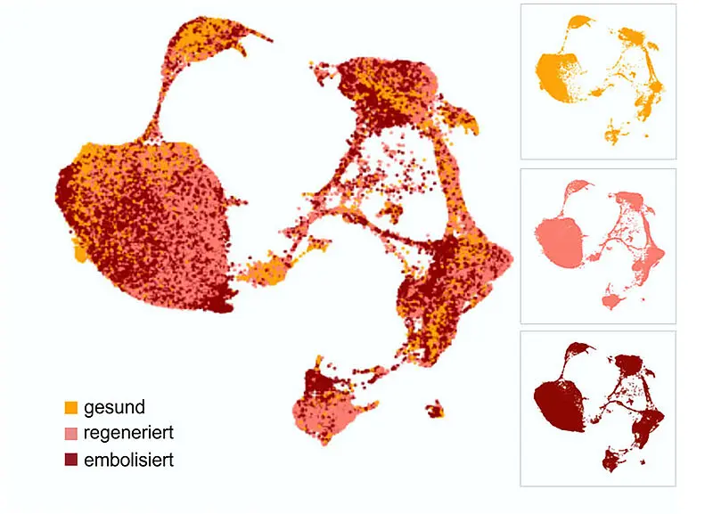 Karte der Leberzellen von gesunden, regenerierenden und embolisierten Leberproben, gefärbt nach dem jeweiligen Zustand. Modifiziert nach Fig. 2c aus der Originalpublikation. | Quelle: Abbildung: Universität Leipzig | Copyright: Quelle: Originalpublikation 