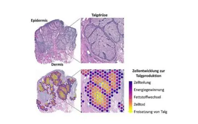 Neue Methode ermöglicht molekulares Porträt der Talgproduktion