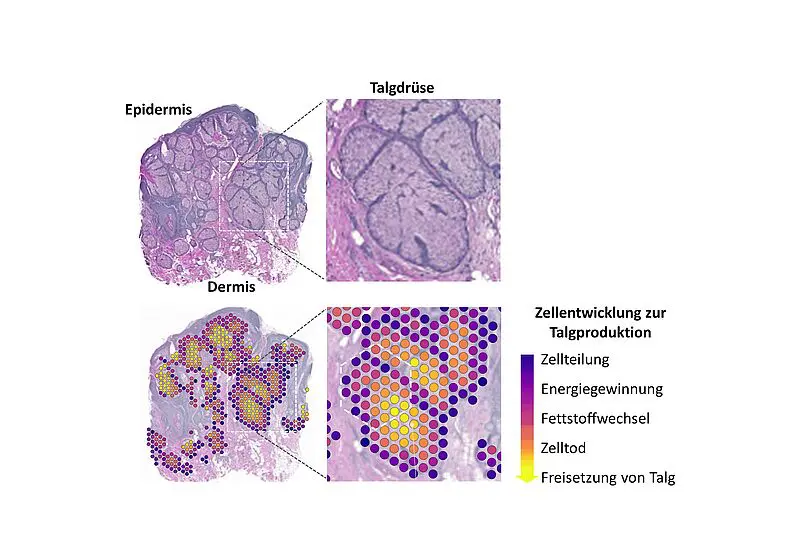 Darstellung der Differenzierung der Talgdrüsenzellen anhand von räumlicher Transkriptomuntersuchung | Copyright: Interdisziplinäres Zentrum für Bioinformatik der Universität Leipzig