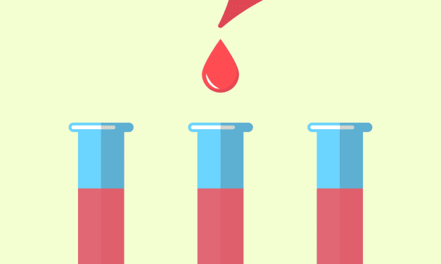 Prognostische Marker: Lipide können Wirksamkeit der Behandlung bei kolorektalem Karzinom vorhersagen