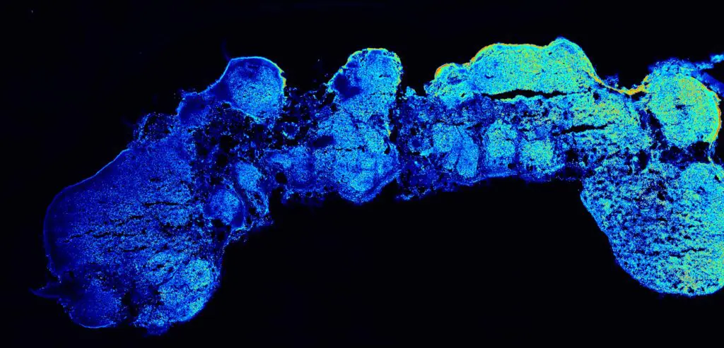 Längsschnitt eines polarisierten kortikalen Assembloids (polCA), wobei der vordere Bereich links (proximal zur FGF8-Quelle) und der hintere Bereich rechts (distal zur FGF8-Quelle) liegt. | Quelle: © Camilla Bosone/IMBA | Copyright: © Camilla Bosone/IMBA 