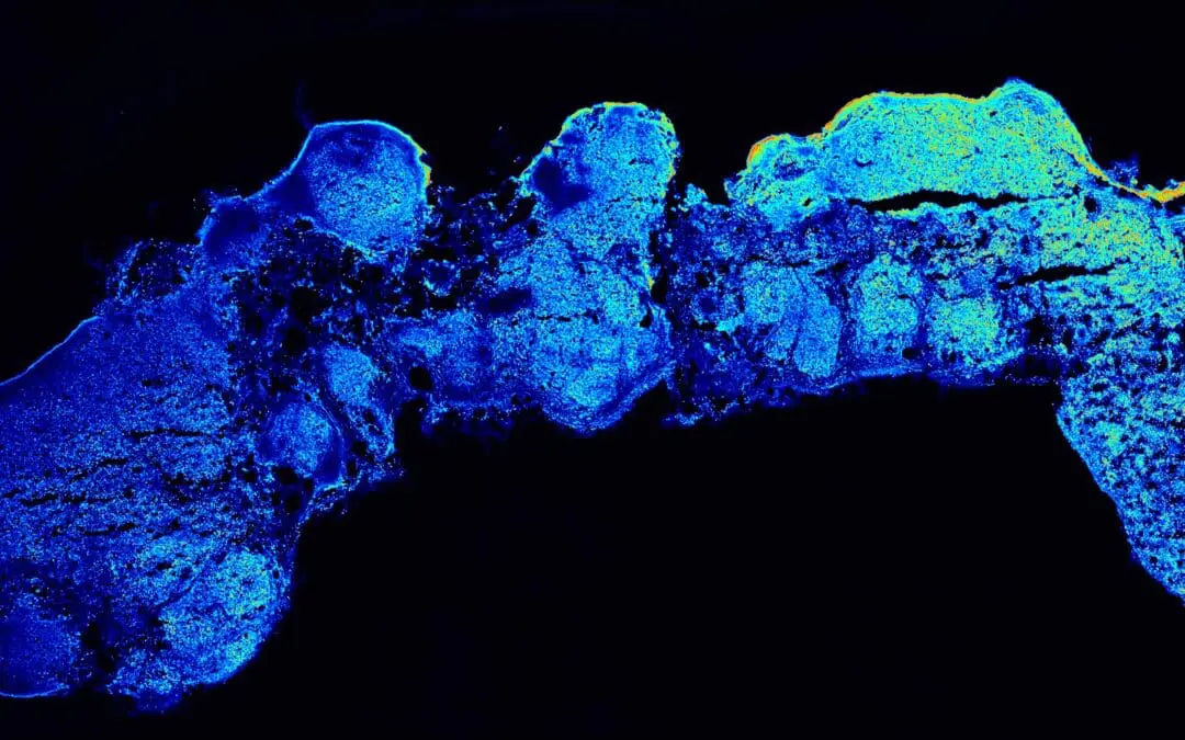 Durchbruch: Gehirnorganoid bildet menschliche Kortexbereiche nach