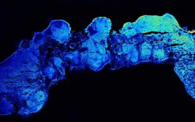 Durchbruch: Gehirnorganoid bildet menschliche Kortexbereiche nach
