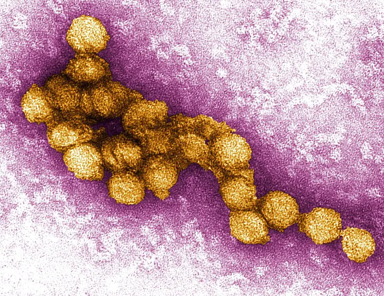 West Nil Virus. Credits: Cynthia Goldsmith PE Rollin USCDCP