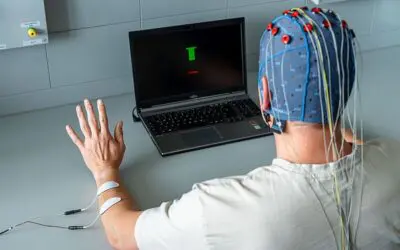 Schlaganfall: Frühzeitige Kombinationstherapie macht den Unterschied