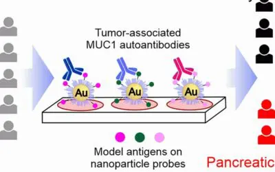 Bauchspeicheldrüsenkrebs: Glykopeptid-Sonden detektieren Tumor-assoziierte Autoantikörper in Blutproben