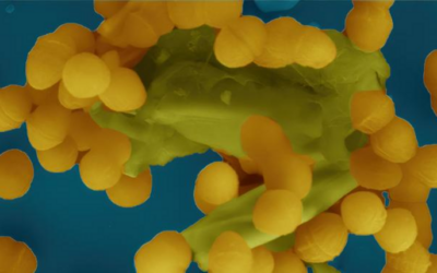 Enzymschere verhilft Bakterien zur Antibiotikaresistenz