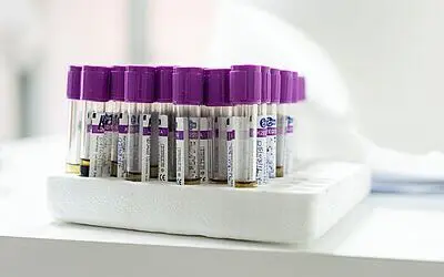 HIV: Resistenztests alleine bringen wenig