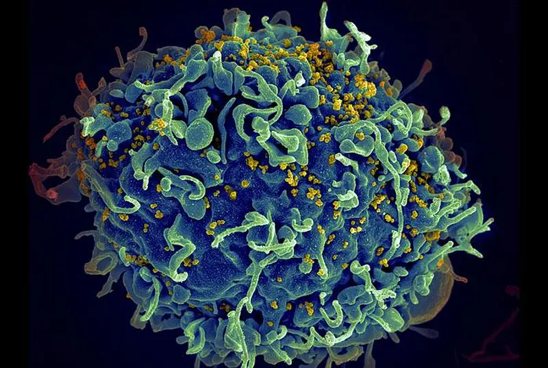 HIV-Partikel (winzige gelbe Kugeln) greifen eine blau dargestellte CD4+ T-Zelle an. Das Virus greift bevorzugt T-Zellen an, die eine entscheidende Rolle bei der Immunreaktion des Körpers gegen Eindringlinge wie Bakterien und Viren spielen. Credits: Seth Pincus, Elizabeth Fischer, Austin Athman/National Institute of Allergy and Infectious Diseases, National Institutes of Health