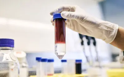 Adoptive T-Zell-Therapie: Kochsalz aktiviert Anti-Tumorzellen