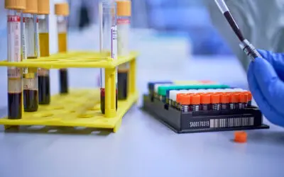 Systemischer Lupus nach Krebsmedikament nicht mehr nachweisbar