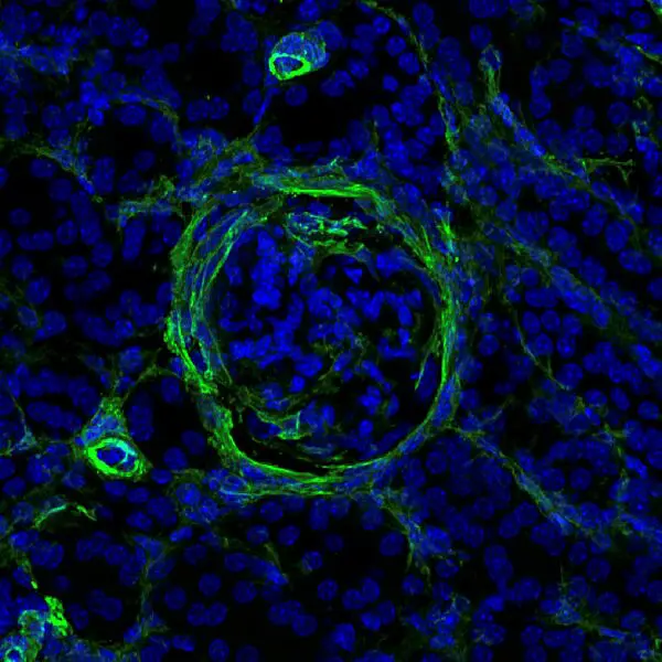 Nierengewebe (Lupus-Mausmodell) mit Zeichen von beginnender Fibrose (grün). Blockiert man den NKp46-Rezeptor der ILC-Zellen, geht die Lupus-Nephritis zurück. Blau: Zellkerne. | Quelle: Frauke Schreiber | Copyright: © Charité | Frauke Schreiber