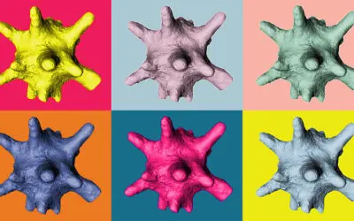 Neuartige Diagnostik für Nierensteine entwickelt