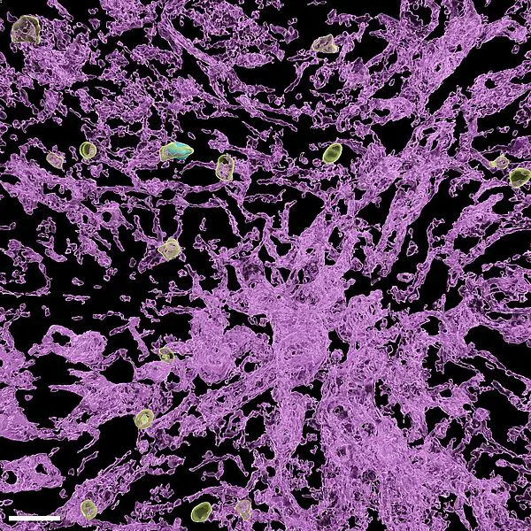 Eine virus-spezifische T Zelle im Gefäßsystems der Leber. Um mit dem Hepatitis-B-Virus infizierte Leberzellen zu erreichen, müssen die Immunzellen in engen Kontakt mit den Endothelzellen der Gefäße treten. | Quelle: Percy A. Knolle / TUM | Copyright: Percy A. Knolle / TUM 