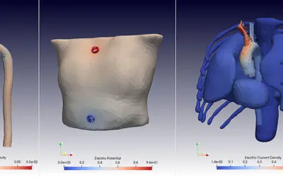 Machine Learning erkennt Herz-Kreislauf-Erkrankungen