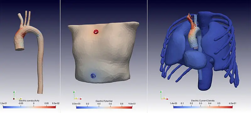 In den Simulationen lassen sich Änderungen in den elektrischen Feldern genau analysieren. | Quelle: arterioscope - TU Graz | Copyright: arterioscope - TU Graz