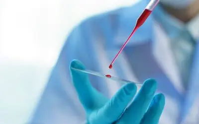 Liquid Biopsy revolutioniert Prostatakrebs-Erkennung