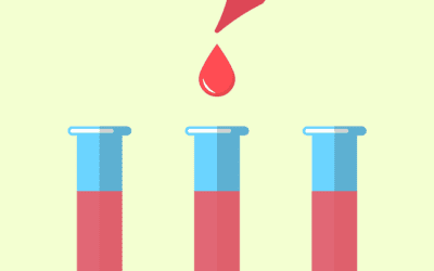 IVDR avanciert zur Herausforderung für die Labormedizin