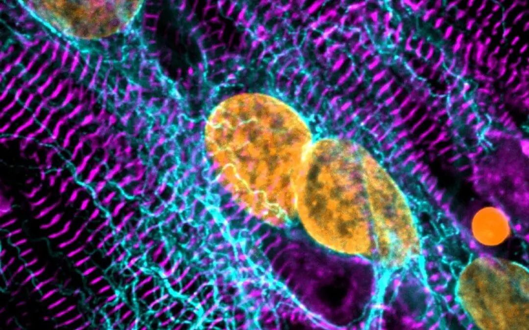 HCM: Gentherapie könnte gegen plötzlichen Herztod bei jungen Menschen wirken