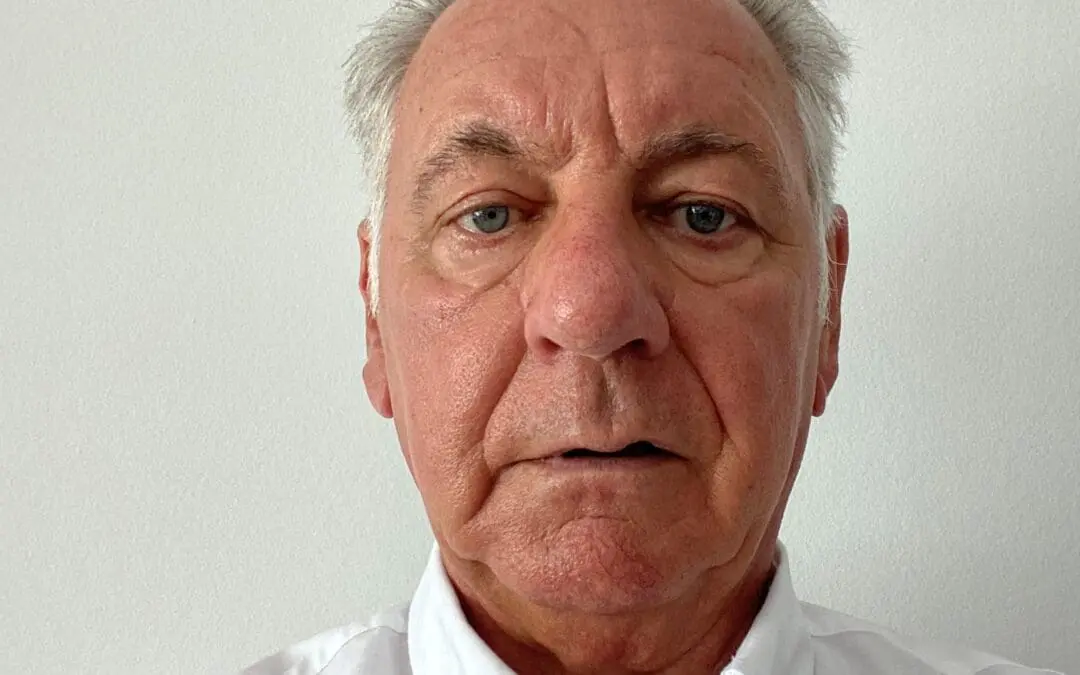 Risiko Gürtelrose: Was Sie darüber wissen müssen