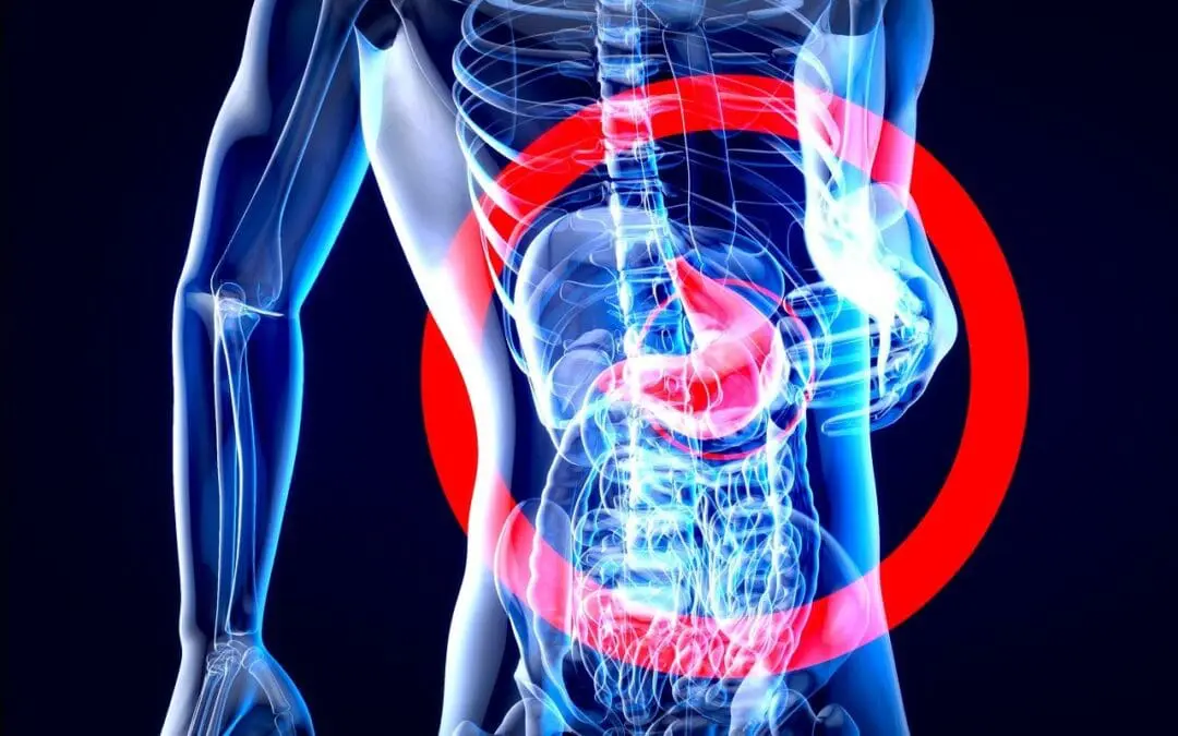 Zulassung: Zolbetuximab verlängert Überleben mit Magenkrebs