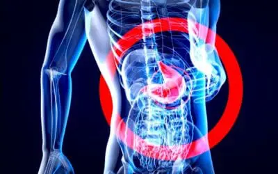 Zulassung: Zolbetuximab verlängert Überleben mit Magenkrebs