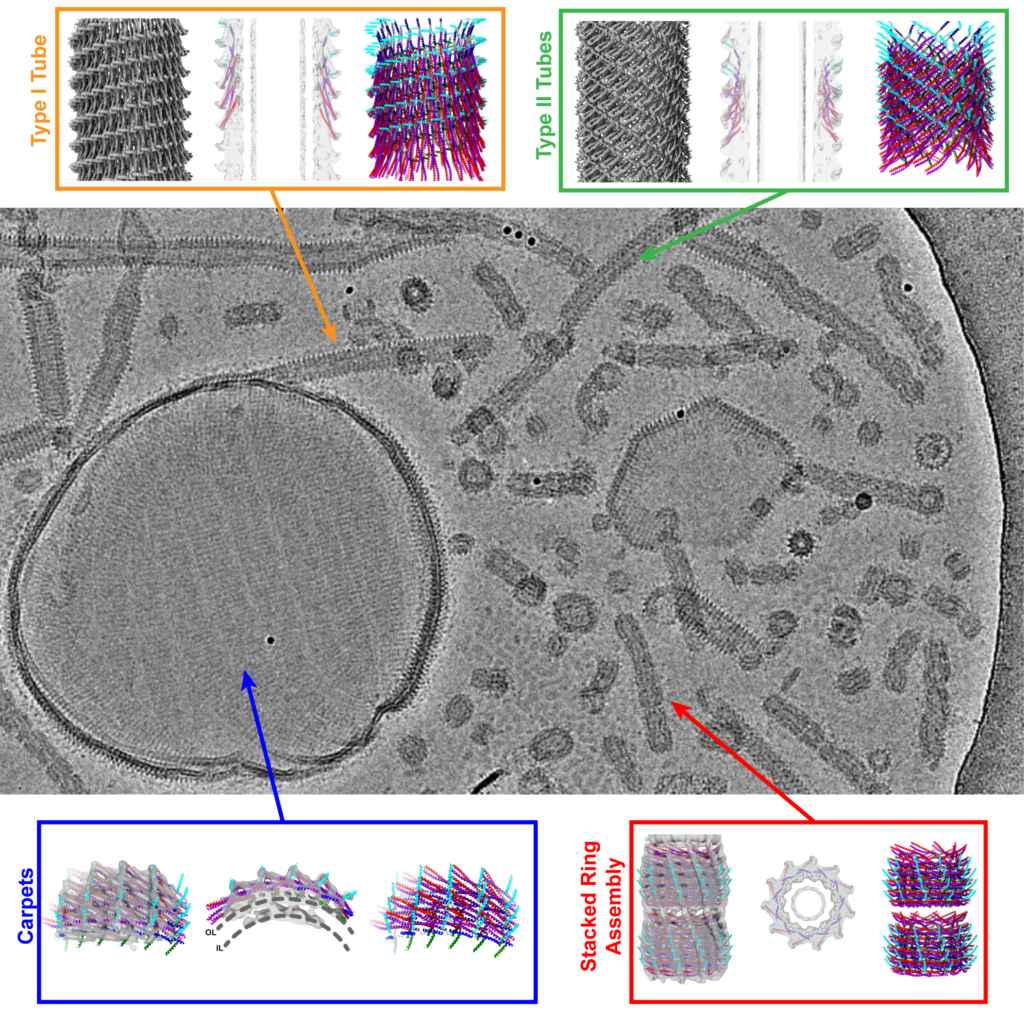 Kryo-EM zeigt verschiedene Vipp1-Strukturen: teppichartige Strukturen („Carpets“), Ringkomplexe („Stacked Ring Assembly“) und Röhren („Type I / Type II Tubes“). | Quelle: Bendikt Junglas, Carsten Sachse | Copyright: Forschungszentrum Jülich / Bendikt Junglas, Carsten Sachse