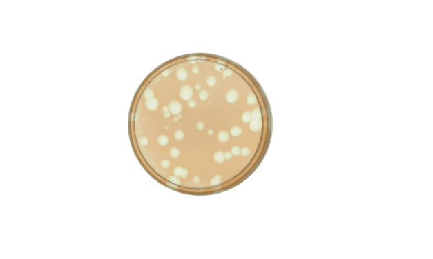 Studie gibt neue Einblicke in Wirkungsweise von Bakteriophagen