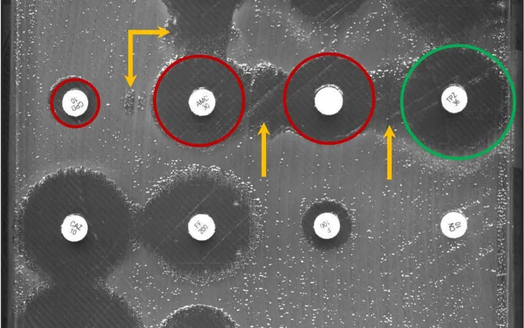 Künstliche Intelligenz erkennt antibiotikaresistente Bakterien schneller als der Mensch