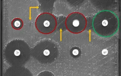 Künstliche Intelligenz erkennt antibiotikaresistente Bakterien schneller als der Mensch