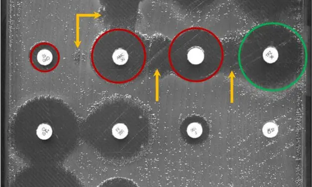 Künstliche Intelligenz erkennt antibiotikaresistente Bakterien schneller als der Mensch