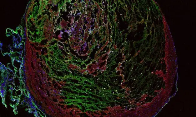 Bislang unerforschter Mechanismus um venöse Thrombose verstanden