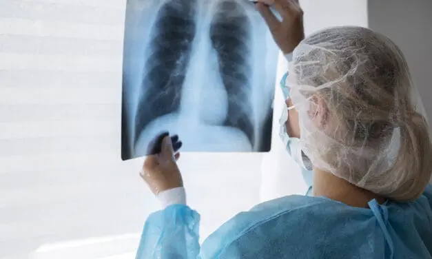 Studie bestätigt gute Wirksamkeit von Capmatinib bei fortgeschrittenem nicht-kleinzelligen Lungenkrebs